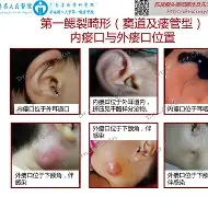 衕?*@?€烅k筁簤娏?稂d;腮?鱚zy2ǖ搟妠蟲?炠莽鲇(B埡J唤憱O?(襵垏of釠?乳Ｑh蓦t涰6)6Z卄的简单介绍-爱游戏平台